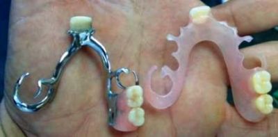 Ministério da Saúde libera recursos para laboratórios de Prótese Dentária, incluindo Iguatemi